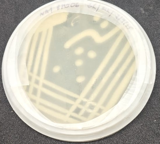 Bharalu bacteria plate
