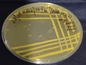Bharalu bacteria