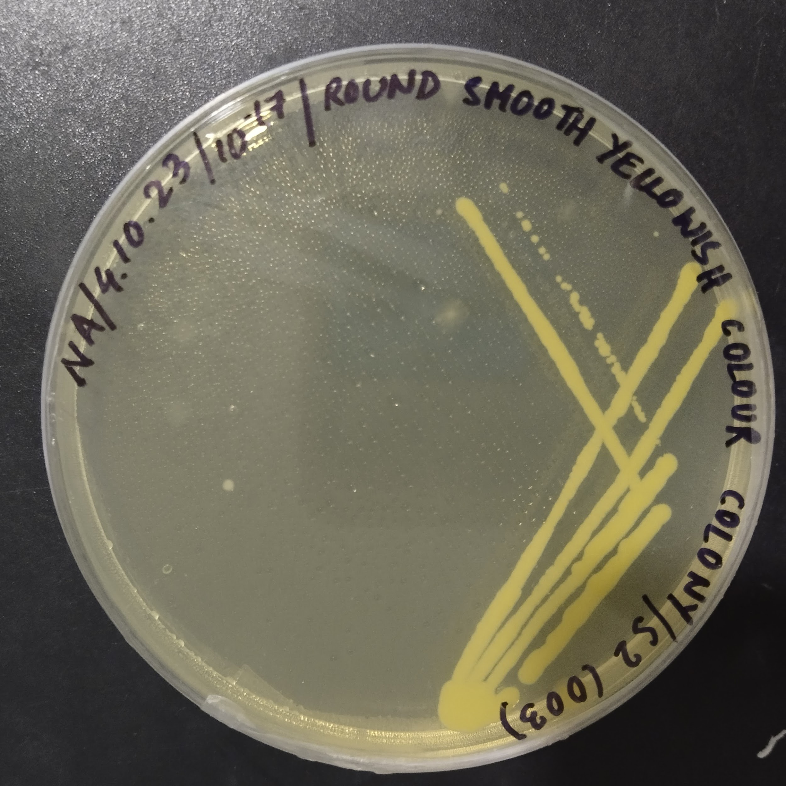 Bharalu bacteria 2