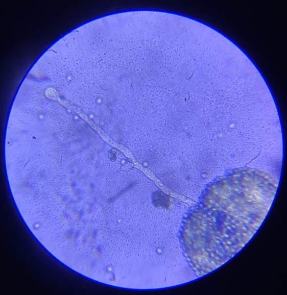 Fungus microscopic