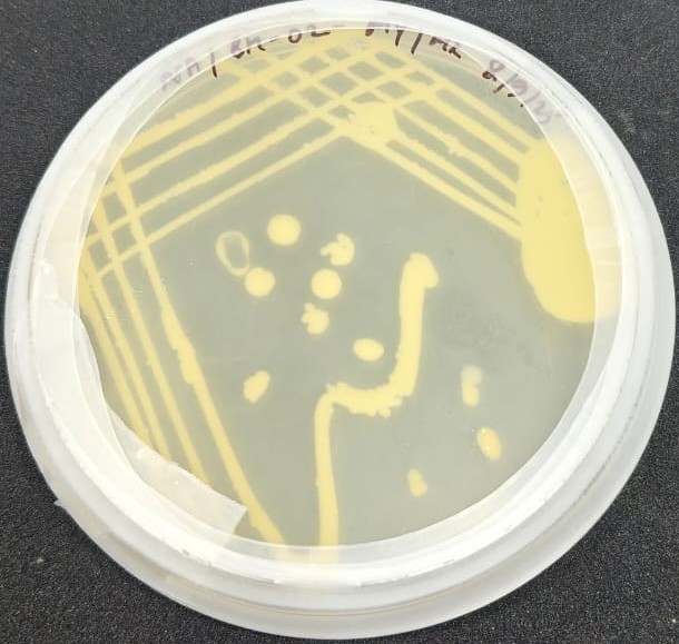 Bacteria 1