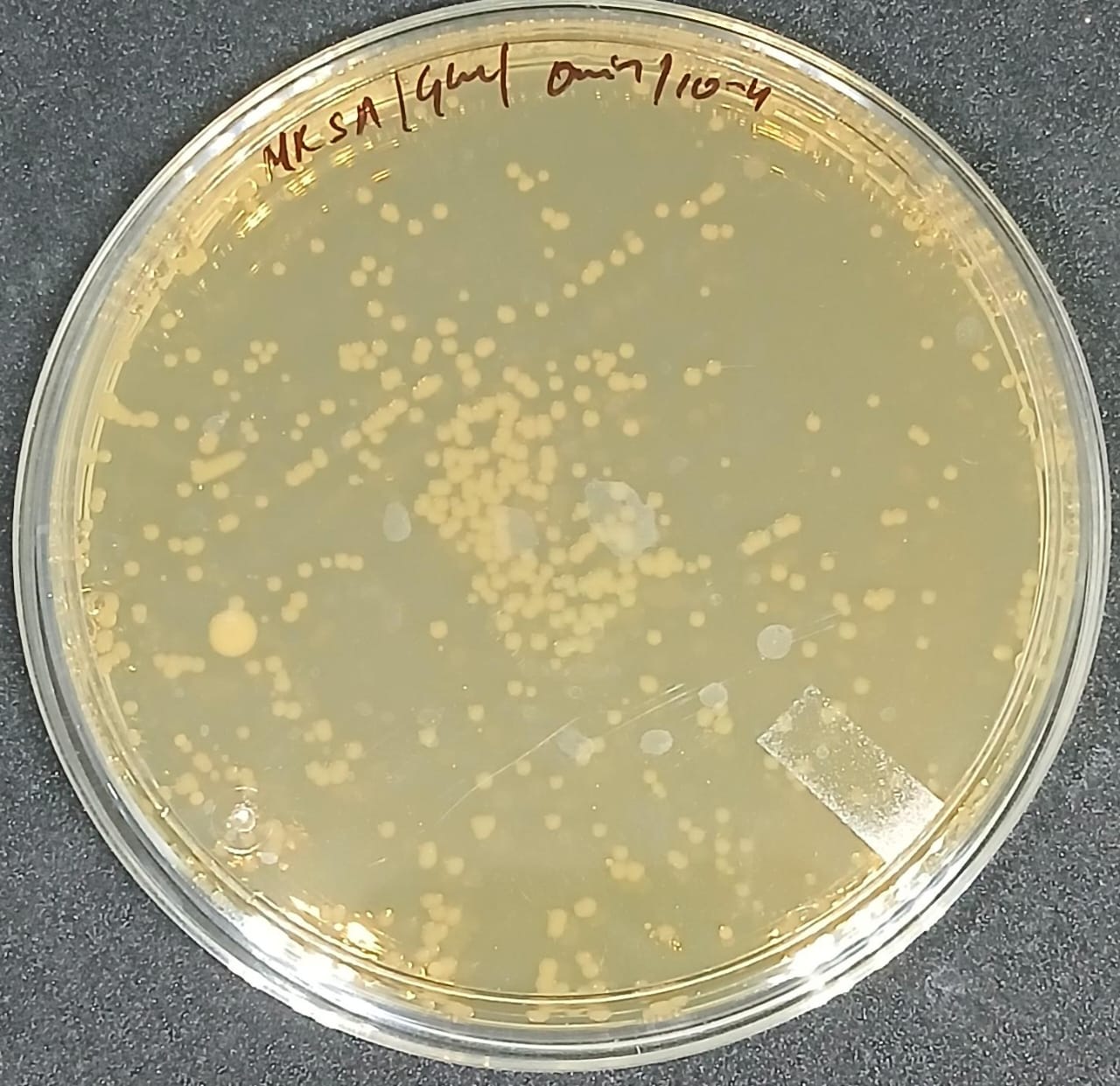 Bacterial count